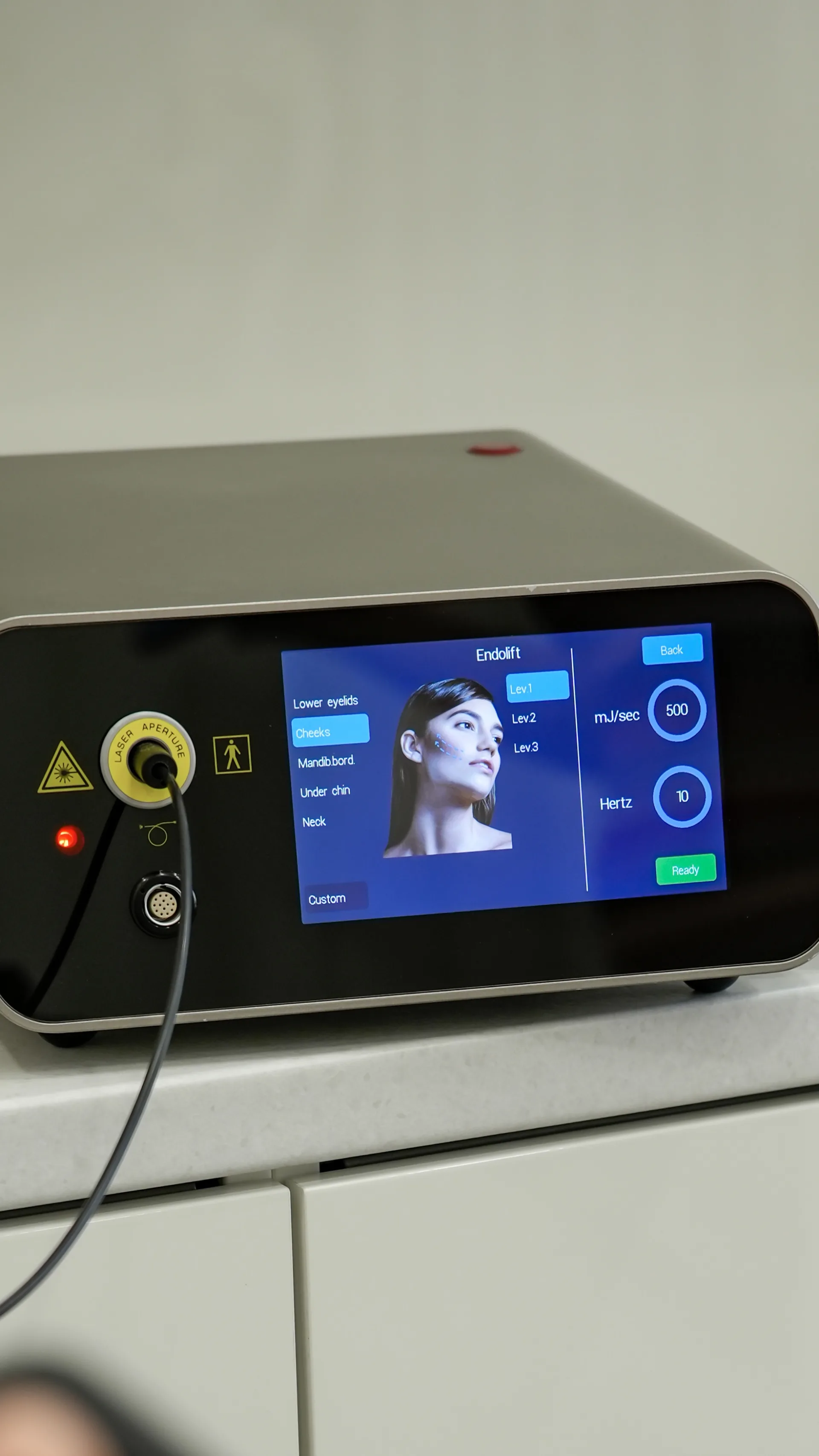 Endolift Nedir? Ameliyatsız Cilt Germe Hakkında Bilinmesi Gerekenler